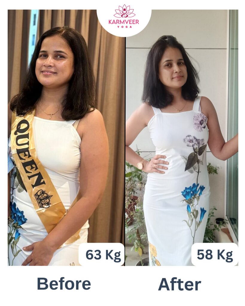 Aparna’s Transformation: Proof That Only Eating Less Isn’t the Answer